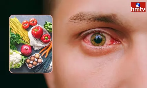 Do Not Eat These Foods If You Get Conjunctivitis The Infection Will Increase