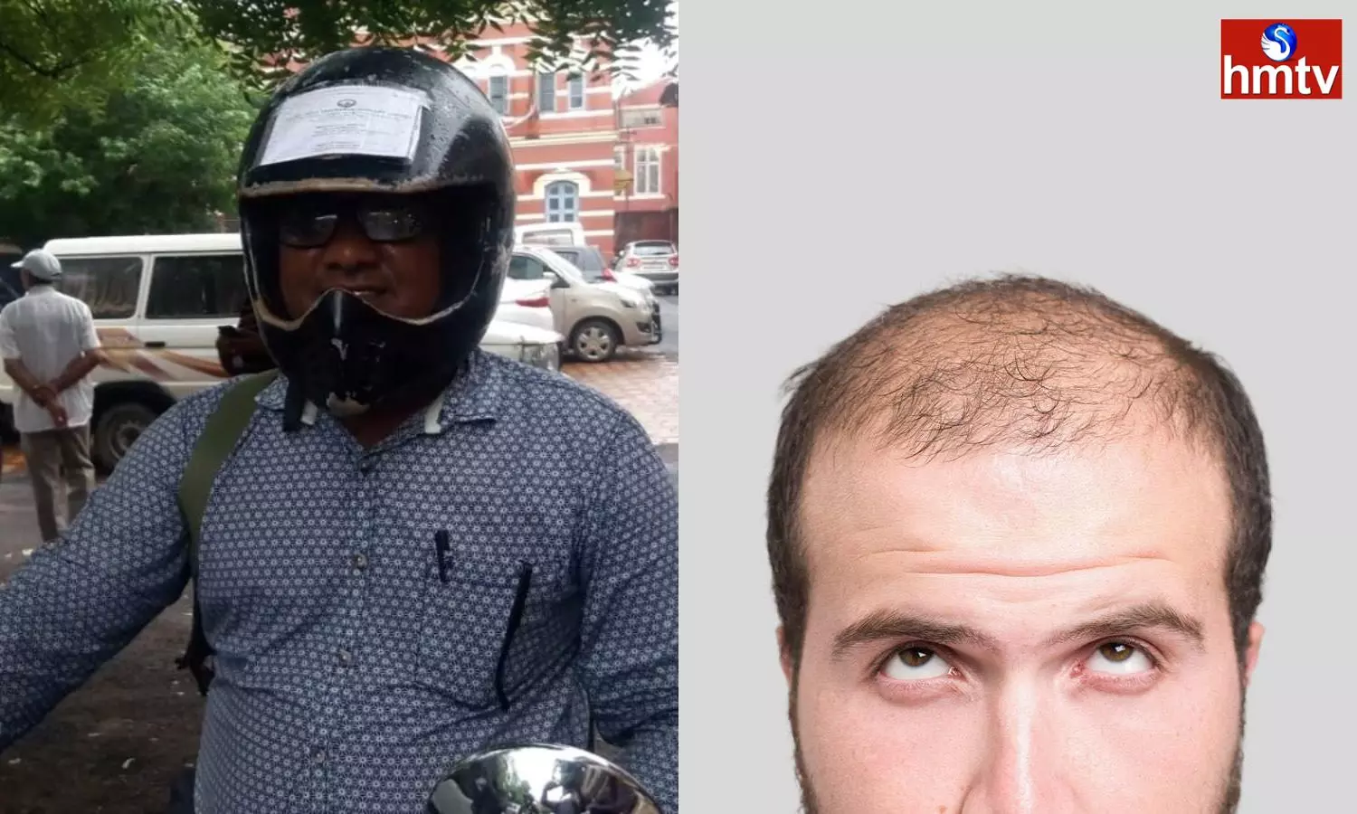 What Is The Relationship Between Helmet And Baldness Know What The Experts Say