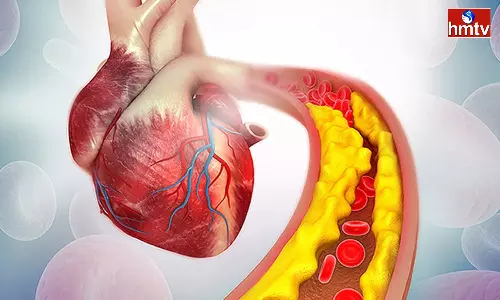 A And B Blood Group People Have A Higher Risk Of Heart Disease Know The Reasons