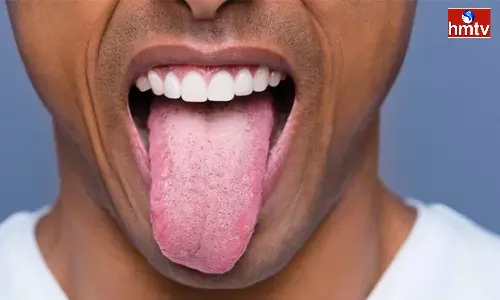 If These Diseases Occur The Taste Of The Tongue Will Change Ignoring It Can Be Very Dangerous If These Diseases Occur The Taste Of The Tongue Will Change Ignoring It Can Be Very Dangerous