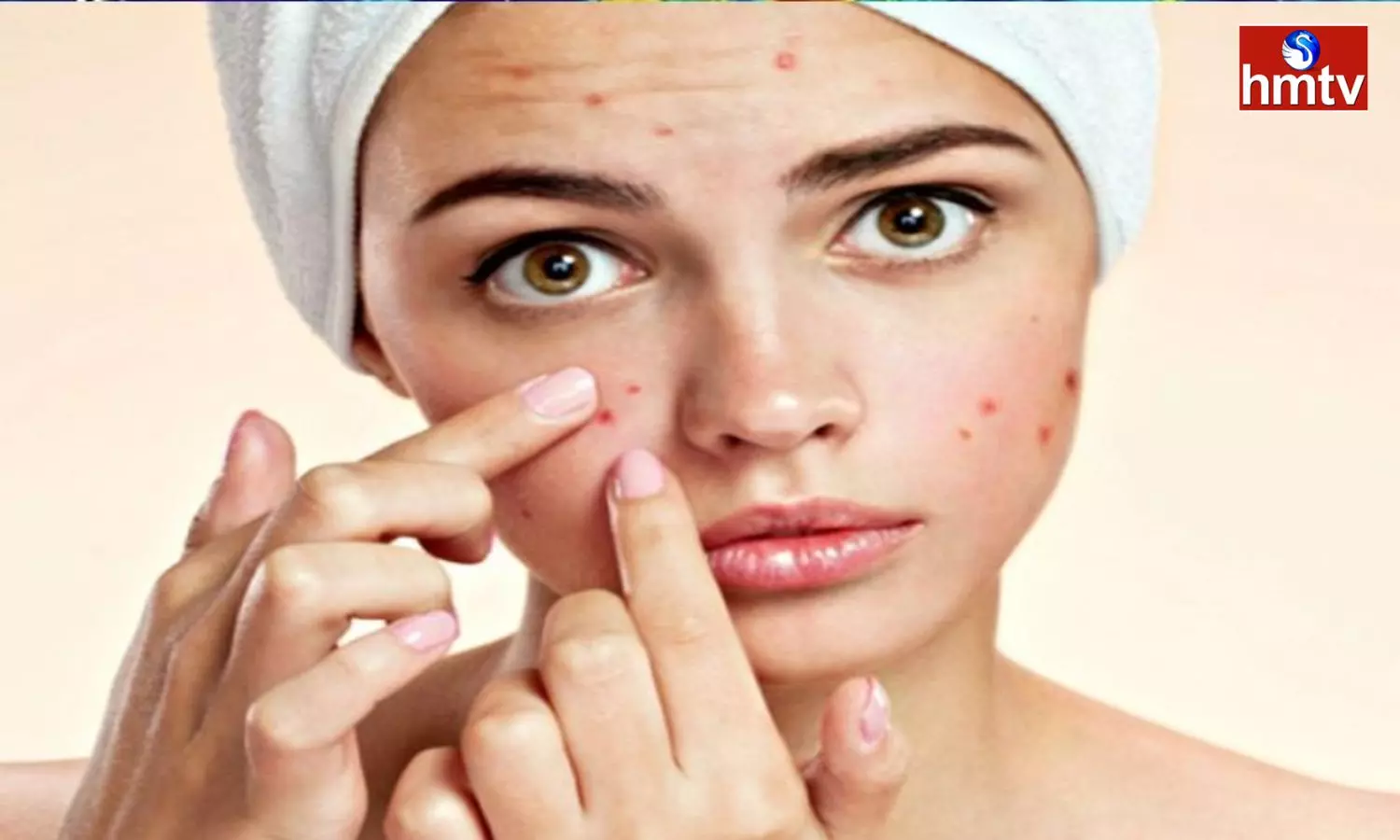 Know The Causes Of Skin Diseases Symptoms And Remedies