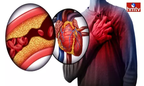 Remember These If You Have a heart Blockage Problem Otherwise It Is Very Dangerous Remember These If You Have a heart Blockage Problem Otherwise It Is Very Dangerous