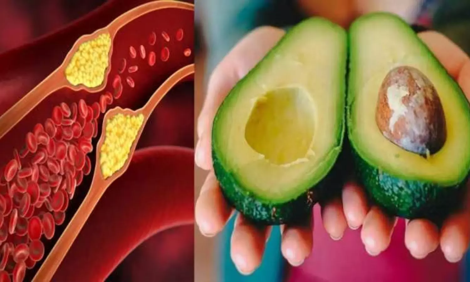 Eating Avocado Daily Reduces Cholesterol in the Body Know Complete Details About This