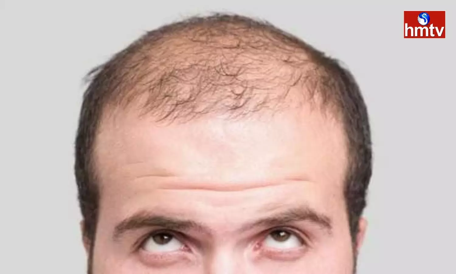 Deficiency Of Zinc In The Body Leads To Baldness Many People Do Not Know This