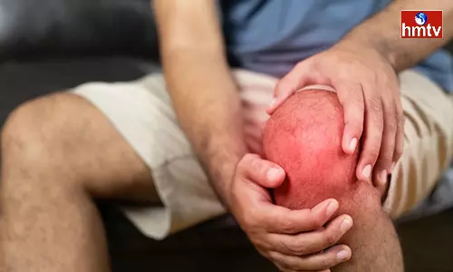 Dont make this mistake in case of Arthritis Bones are Completely Damaged Dont make this mistake in case of Arthritis Bones are Completely Damaged