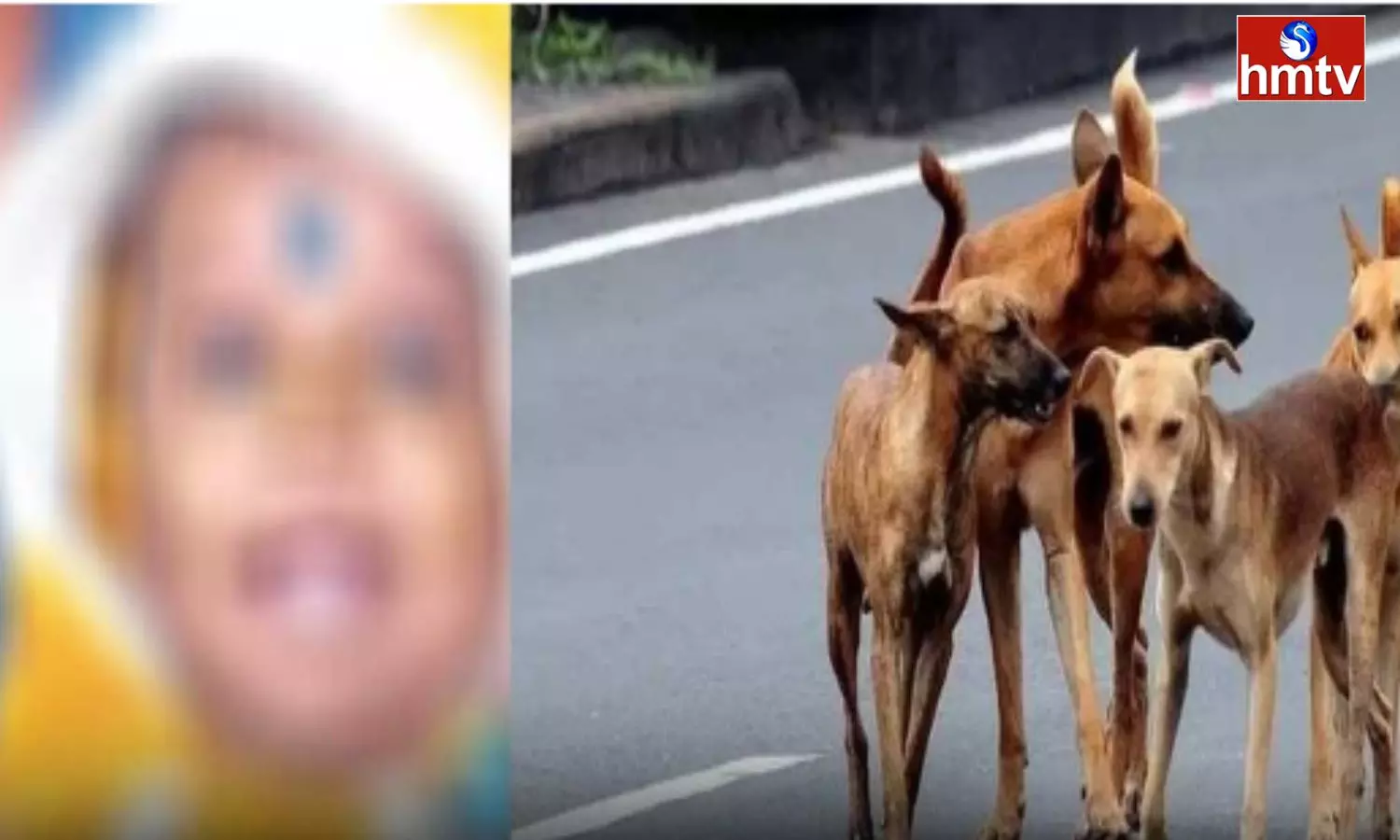 Five-Year-Old Child Dies In Stray Dog Attack In Hyderabad Five-Year-Old Child Dies In Stray Dog Attack In Hyderabad