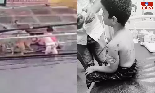 Six-Year-Old Boy Attacked By Stray Dogs In Guntur District