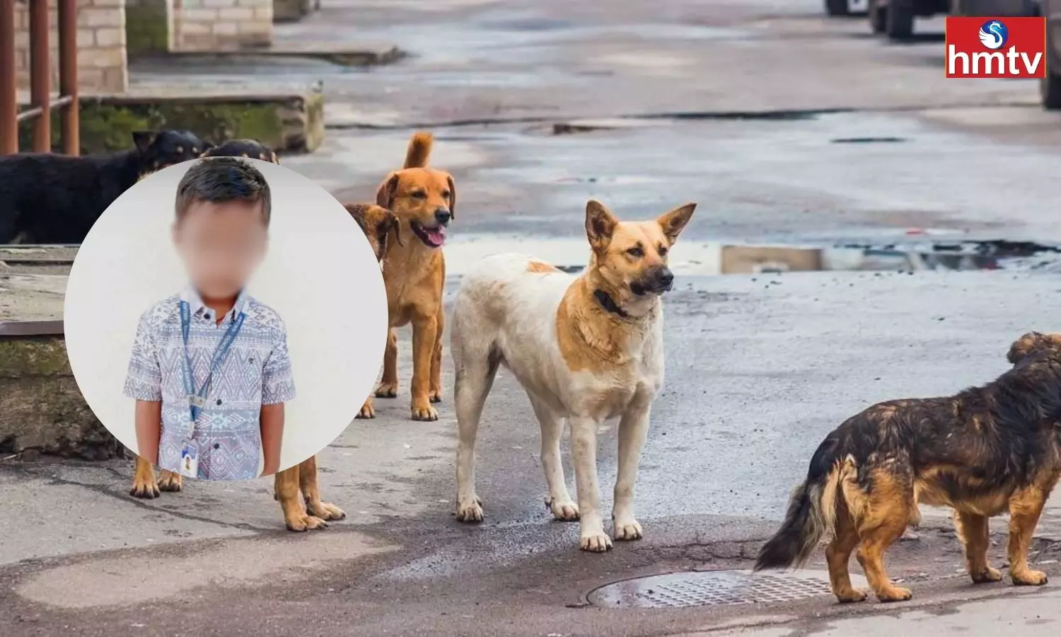Five-Year-Old Boy Died Due to Dog Bite