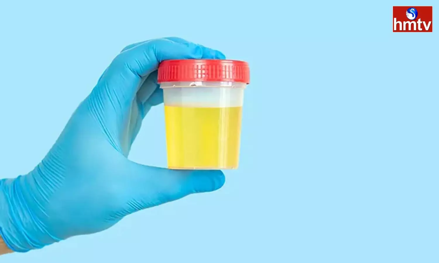 Find Out The Reasons Why Urine Is Yellow