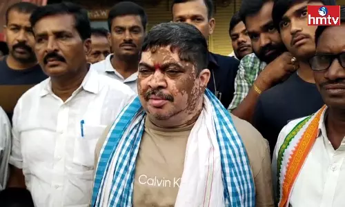 Minister Ponnam Prabhakar visit to Siddipet District