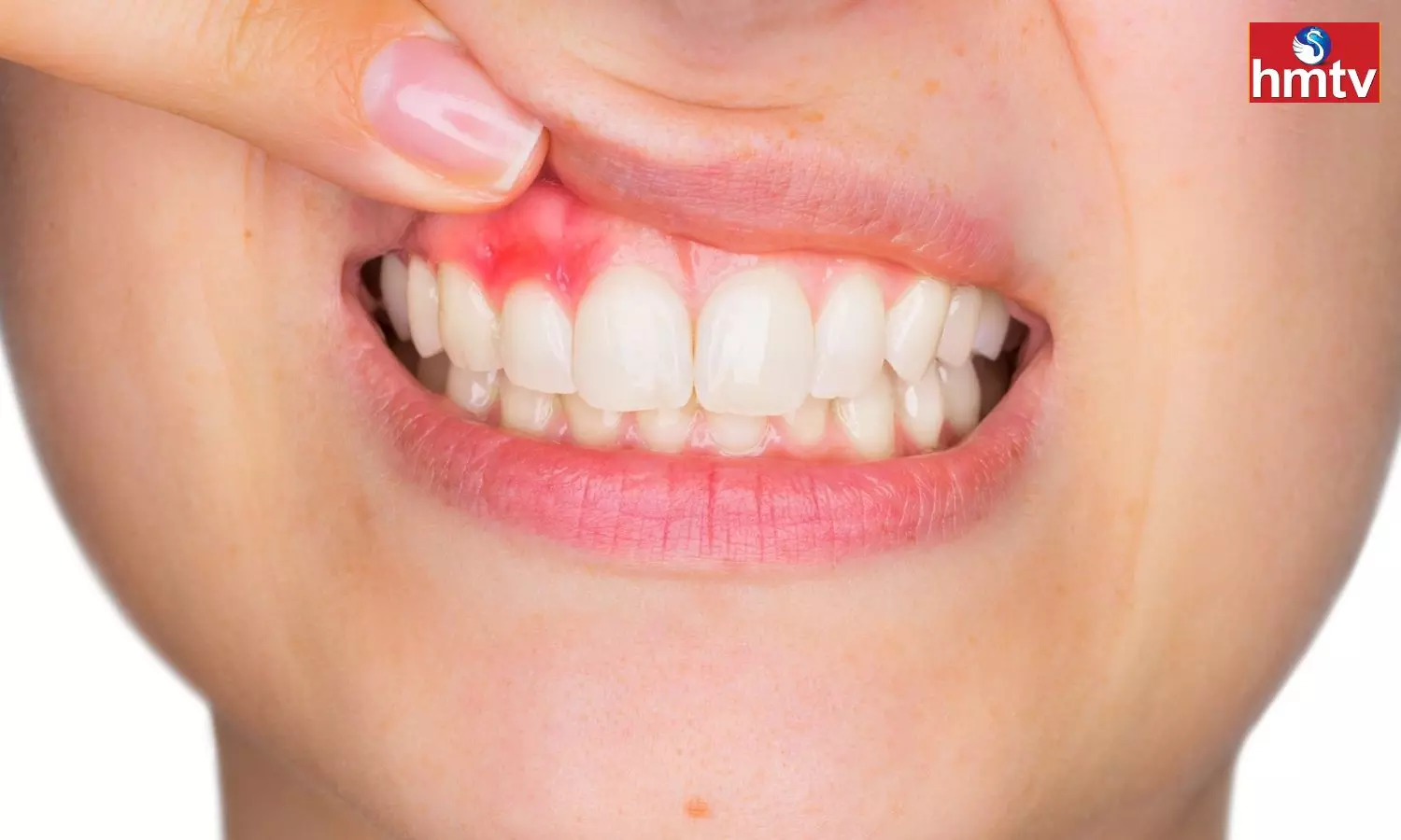 Avoid Using A Toothpick After Eating Or Else Your Teeth Will Get Damaged
