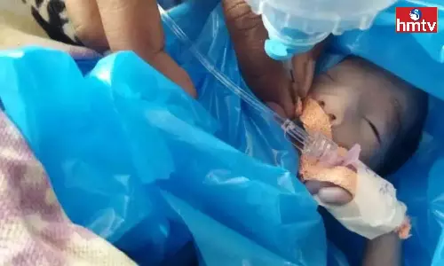 Four Children Are Born In One Litter in Medchal Four Children Are Born In One Litter in Medchal