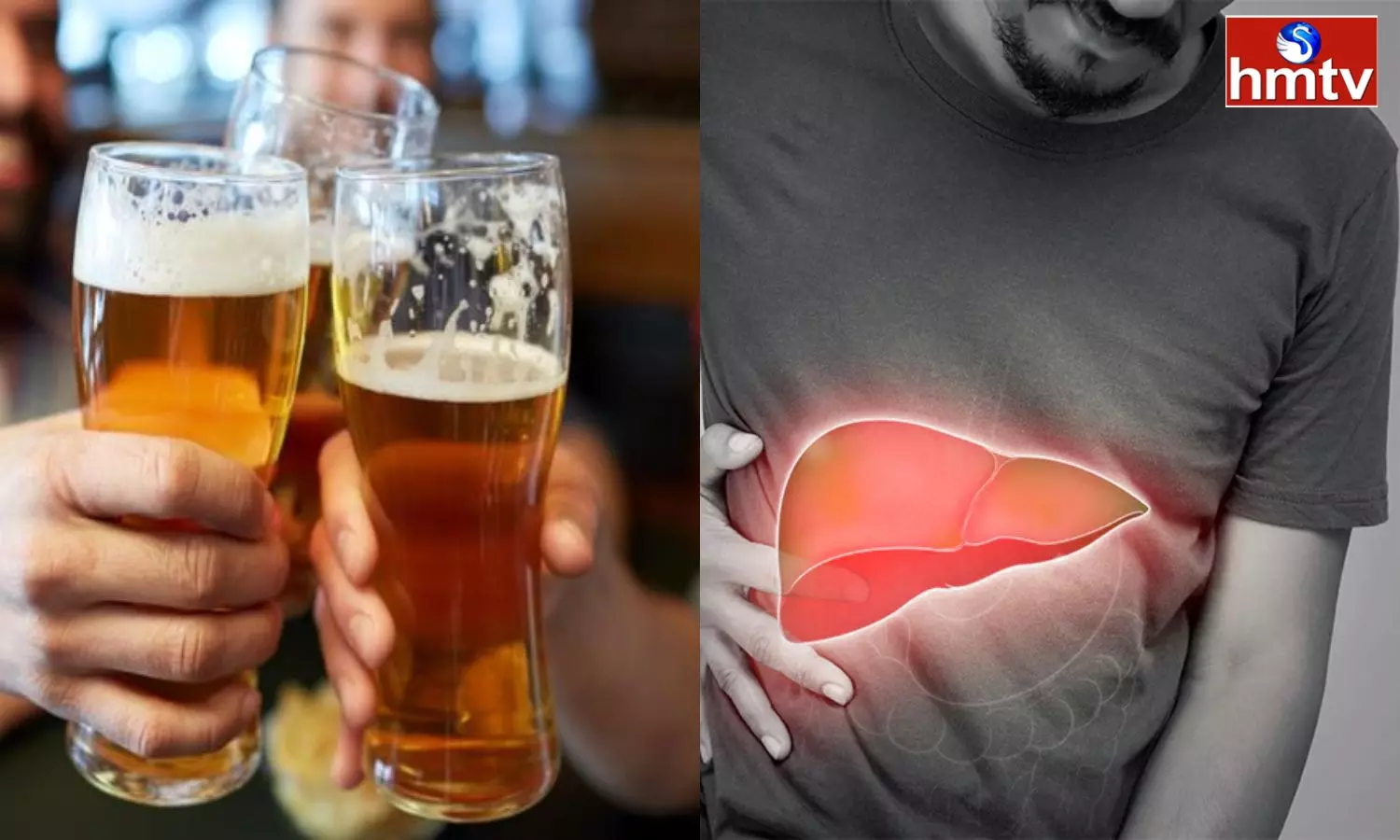 Fatty Liver Problem Occurs Even if You Do Not Drink Alcohol Know the Reasons