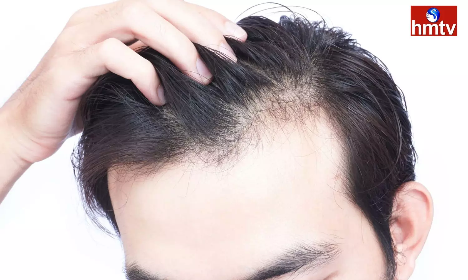 Is Hair Thinning Day By Day Know The Reasons And Choose Remedies