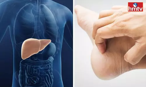 If There Is An Itch In The Palms Of The Hands And The Soles Of The Feet Know That The Liver Is In Danger If There Is An Itch In The Palms Of The Hands And The Soles Of The Feet Know That The Liver Is In Danger