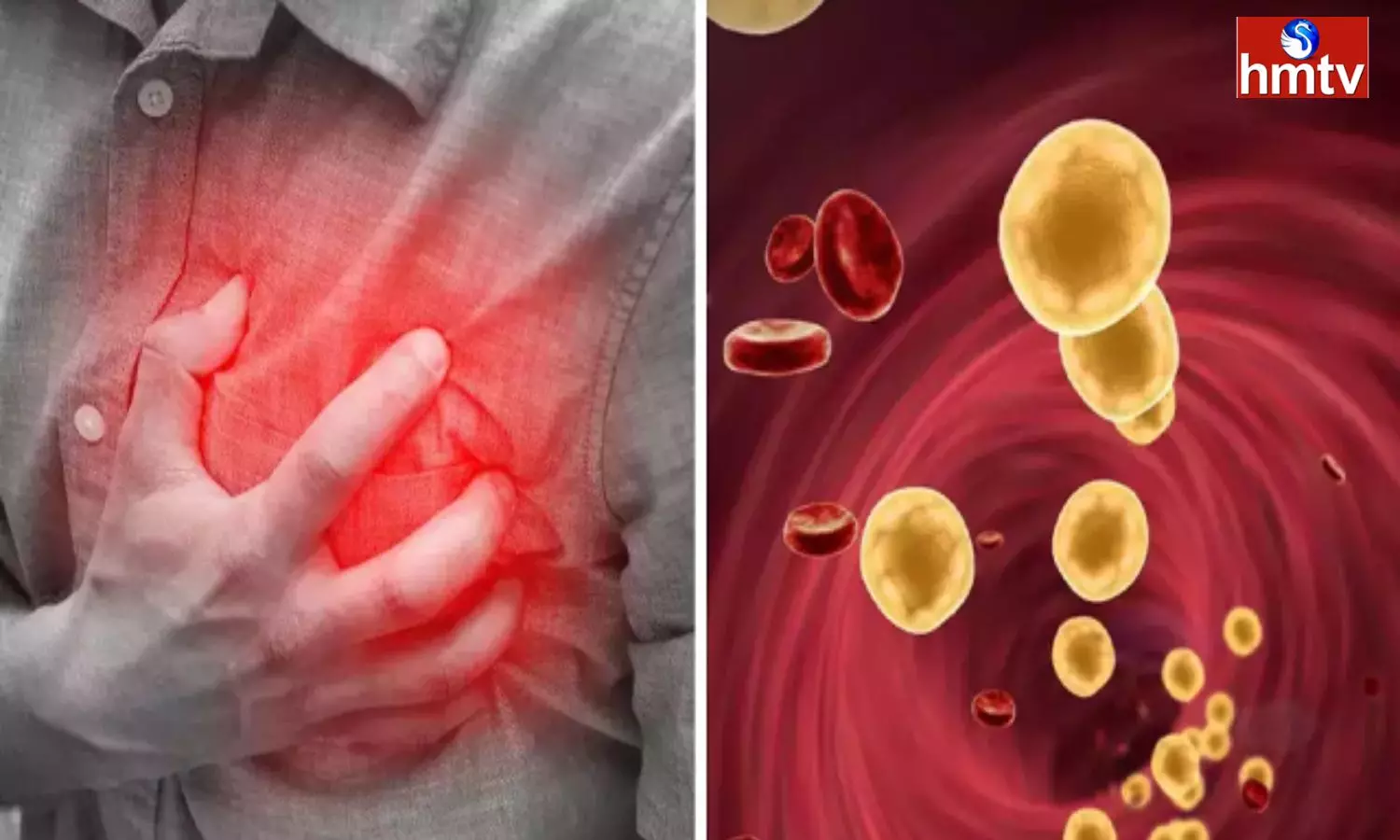 How Does Cholesterol Harm The Body This Is Why These Major Problems Arise