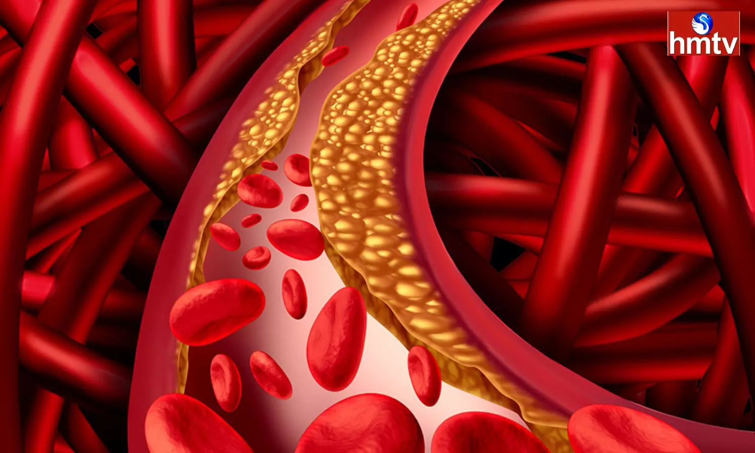 Do you have high cholesterol percentage in the body know these Remedies
