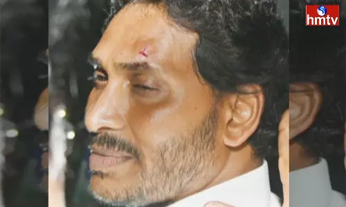 Attack On AP CM YS Jagan In Bus Yatra