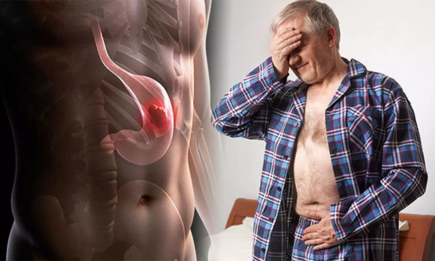 Do You Often Have Trouble In Your Stomach Know About Stomach Cancer