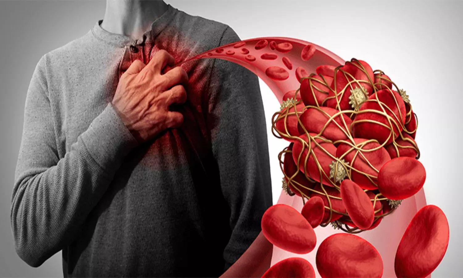 Blood Clotting Problems Are Increasing In The Body Know The Reasons
