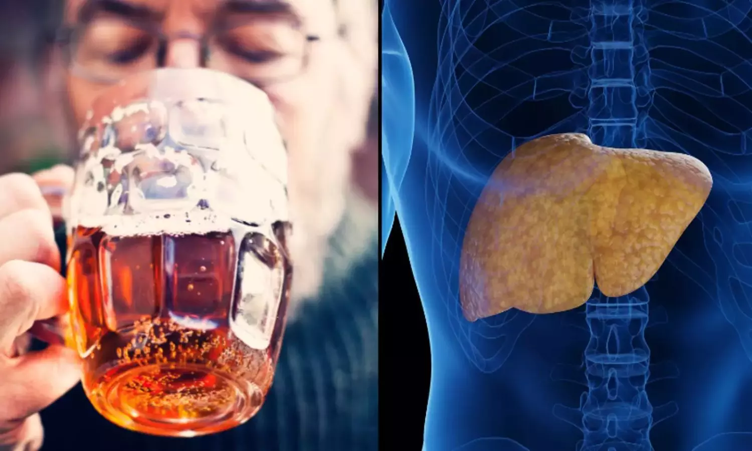Are You Drinking Too Much Alcohol You Have To Take Nanogel To Protect Your Liver