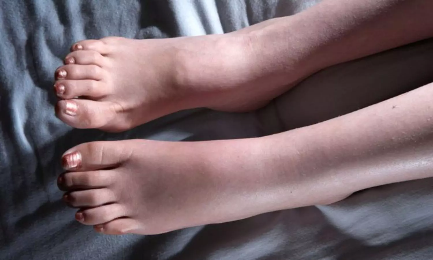 Find out if the legs and feet are swollen or edematous