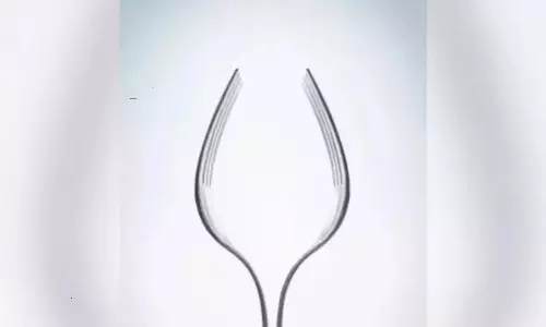 Whats you see first in this photo can reveals what is your charecter Whats you see first in this photo can reveals what is your charecter