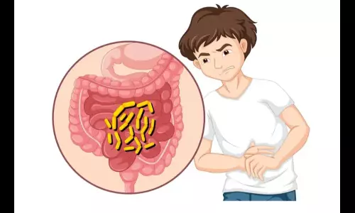 Cholera cases If these symptoms appear, take precautions