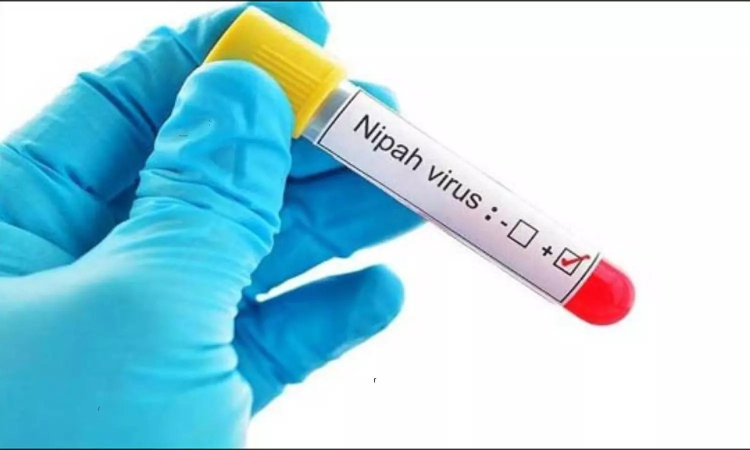 14-year-old boy dies of Nipah virus in Kerala