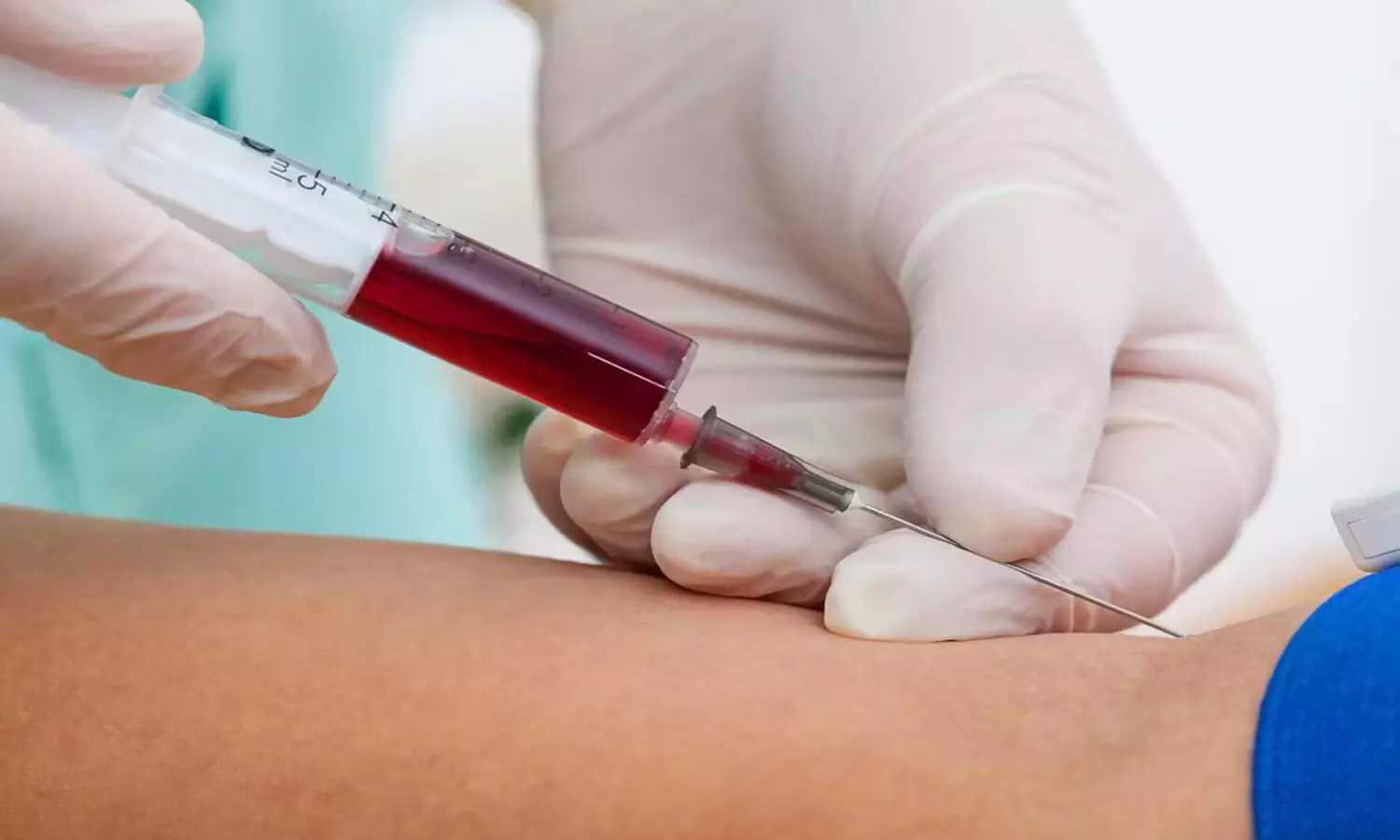 blood tests should be done regularly once a year