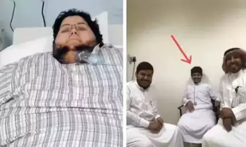 Worlds heaviest man Khalid Shaari sheds 542 kg, now unrecognizable at 63 kg how is it possible