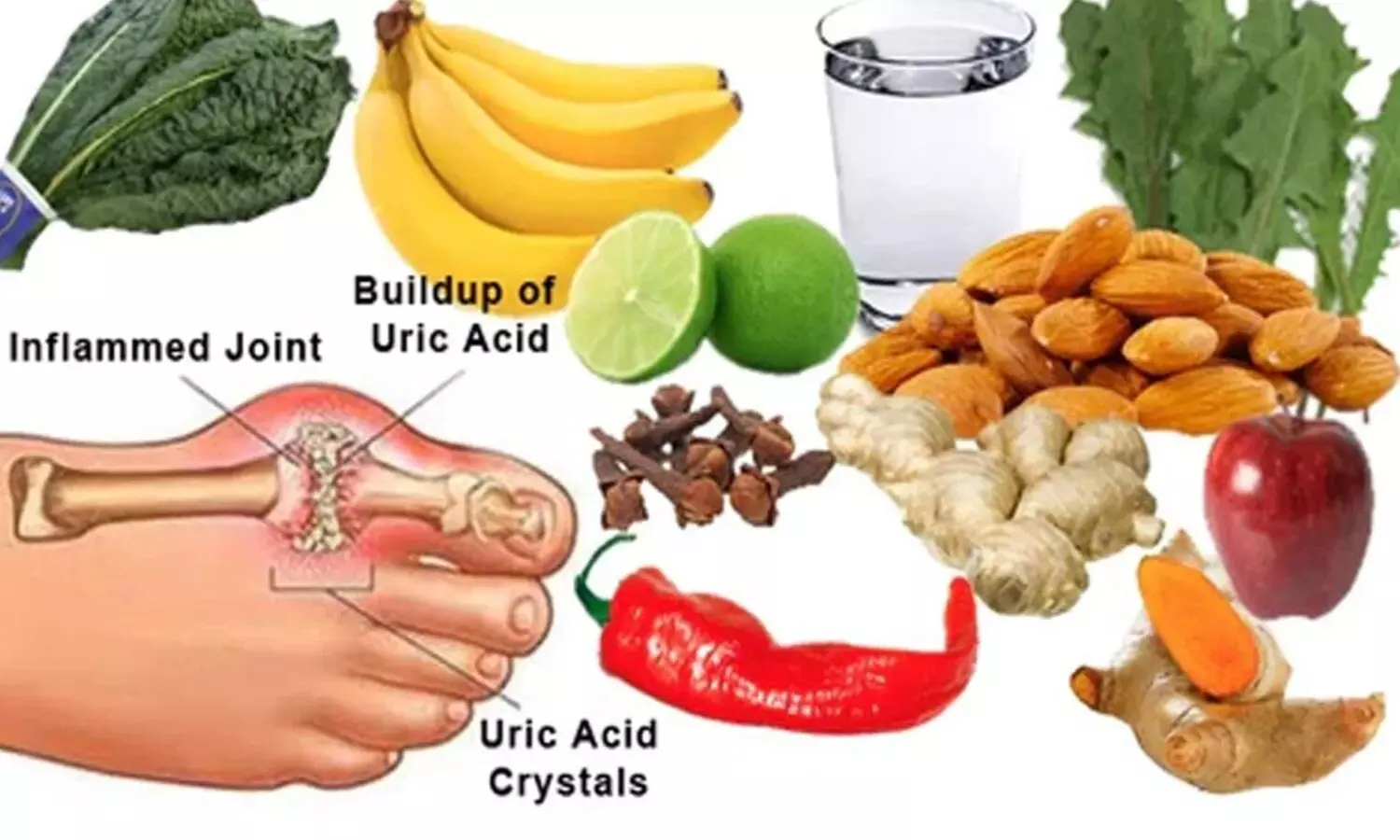 Eating these foods is the solution to uric acid problem