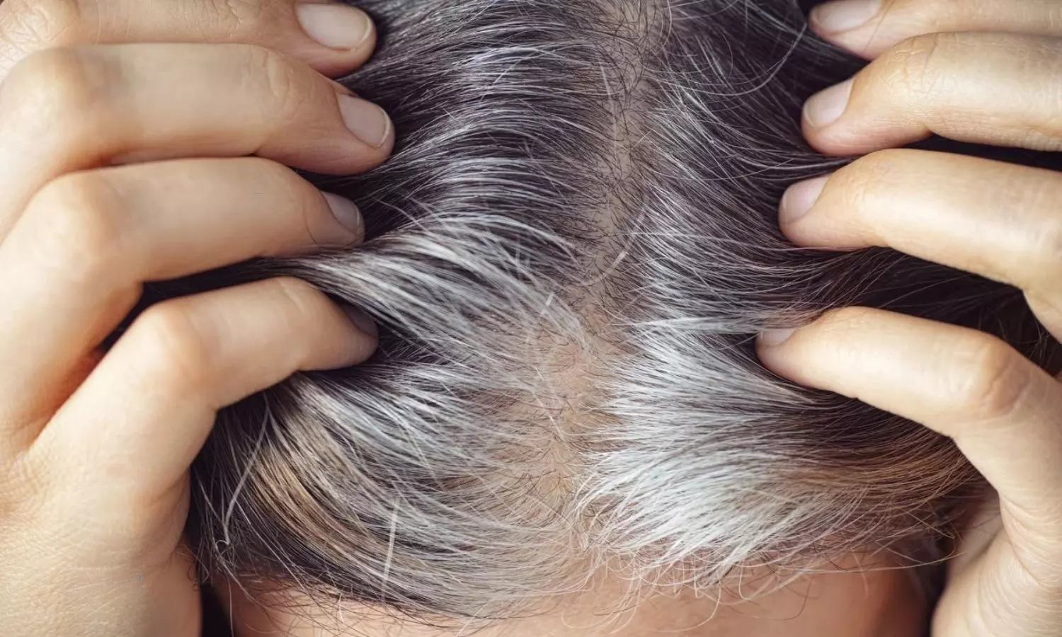 These are the food can cause for white hair