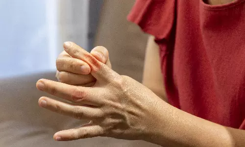 Take These Food to Overcome From Uric Acid Problem