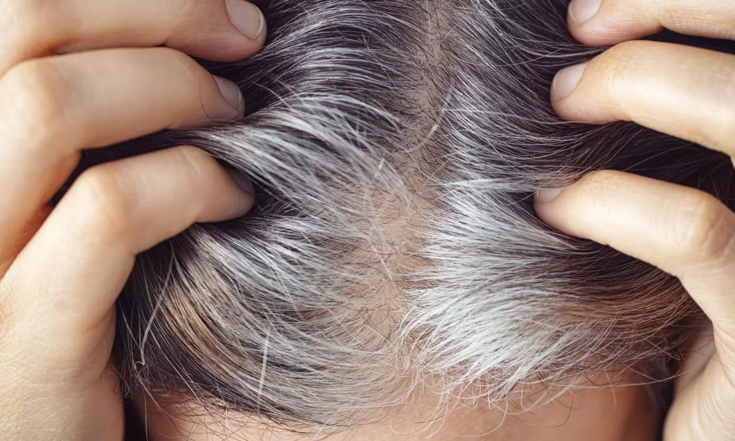 Solutions for White Hair: తెల్ల జుట్టుతో ఇబ్బంది పడుతున్నారా? అయితే దీనికి కారణాలు ఏంటో తెలుసా?