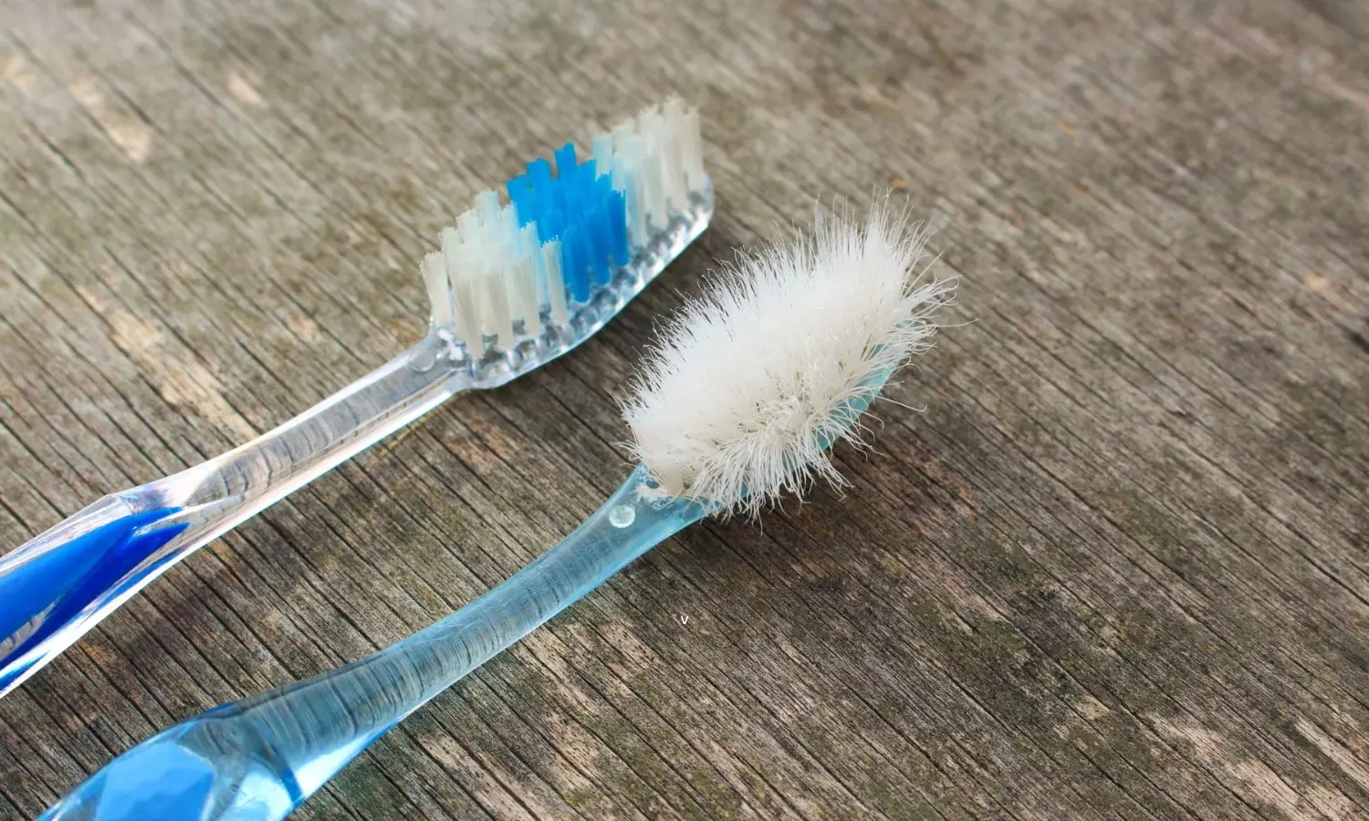 How Often Should You Change Your Toothbrush