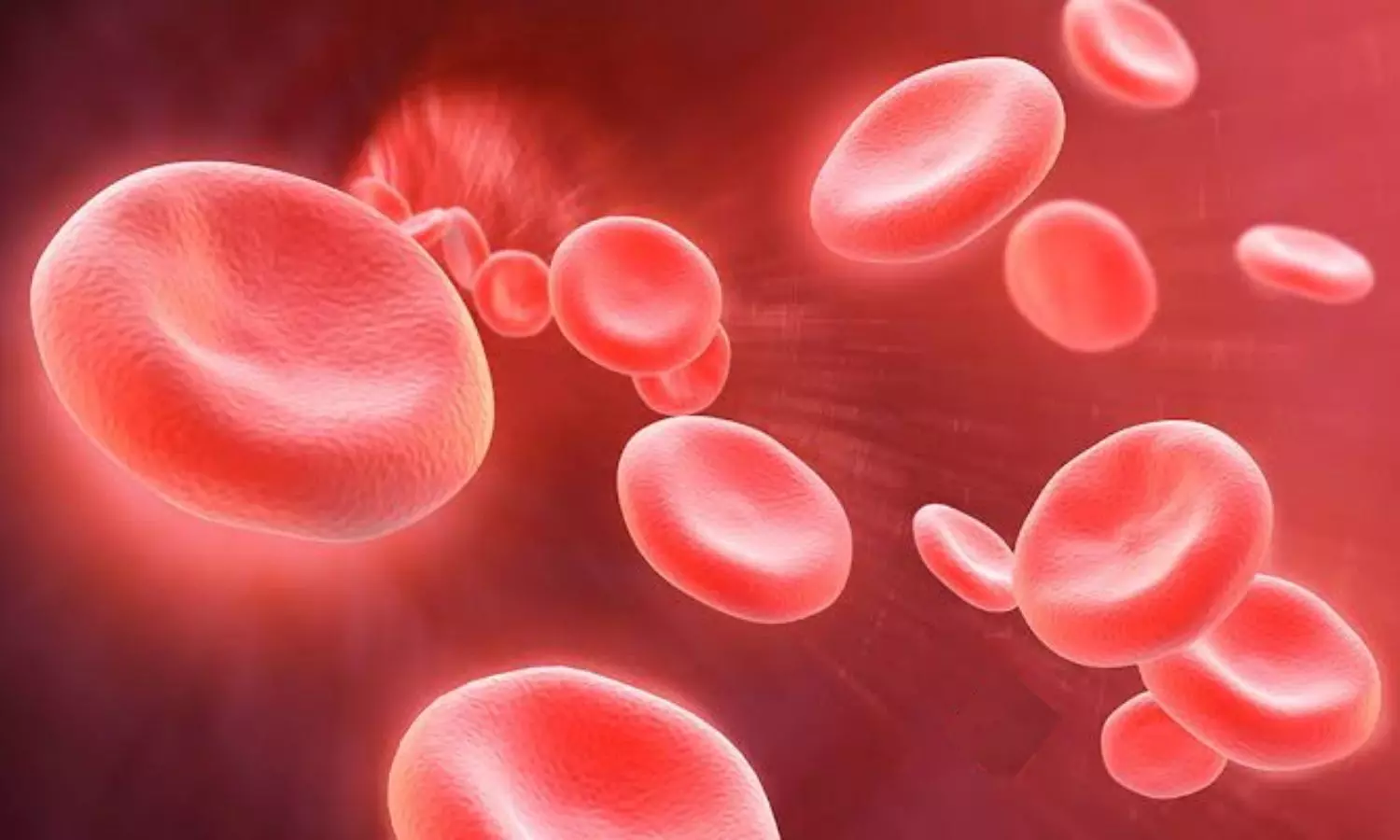 Foods to overcome Anemia problem