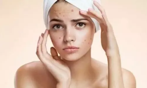 Beauty Tips: ఇలా చేస్తే.. ముఖంపై నల్లటి మచ్చలు మటుమాయం అంతే..! Beauty Tips: ఇలా చేస్తే.. ముఖంపై నల్లటి మచ్చలు మటుమాయం అంతే..!