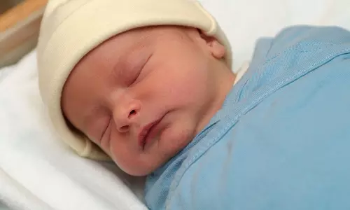 Newborn Jaundice: Causes, Symptoms, and Effective Treatments for Babies