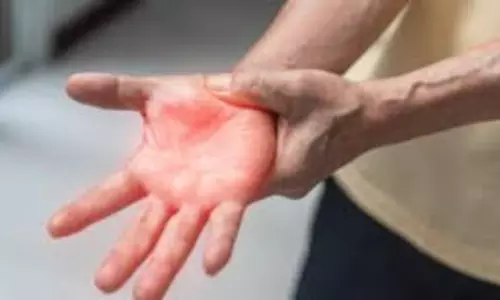 Guillain-Barré Syndrome