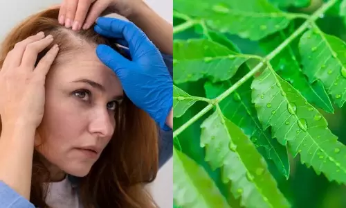 Neem Leaves: చుండ్రు వేధిస్తుందా.. అయితే వేపతో ఇలా చెక్ పెట్టేయండి..!