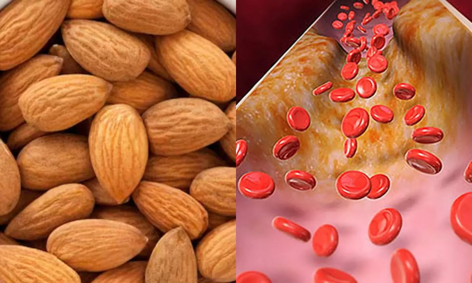 Almonds Reduce Bad Cholesterol and Boost Brain Health Benefits You Must Know