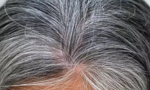 White Hair White Hair