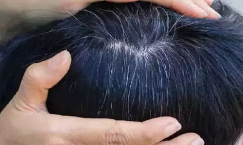 White Hair White Hair