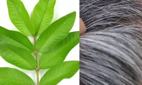 White Hair White Hair