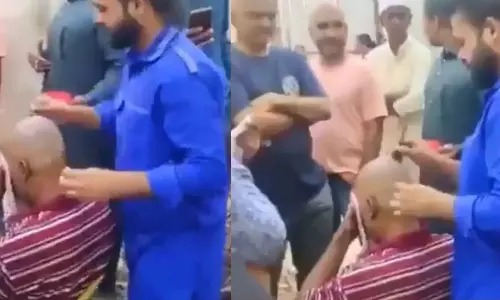 Anti hairfall treatment and hair growth treatment for bald head people led to headache and other health issues, Hyderabad Barber on run Anti hairfall treatment and hair growth treatment for bald head people led to headache and other health issues, Hyderabad Barber on run