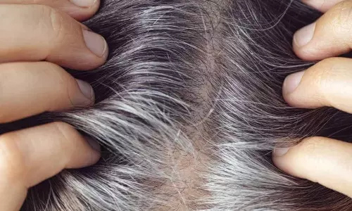 White Hair Turn Black White Hair Turn Black