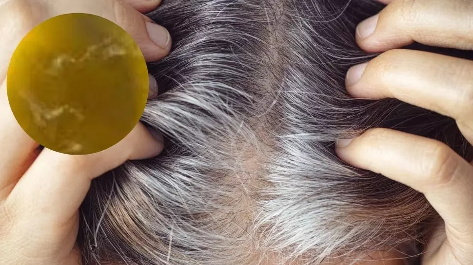 White Hair: జుట్టుకు రంగు వేయకండి.. ఈ పండ్ల రసం రాసుకుంటే తెల్ల జుట్టు సహజంగా నల్లగా మారుతుంది..