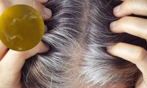 White Hair: జుట్టుకు రంగు వేయకండి.. ఈ పండ్ల రసం రాసుకుంటే తెల్ల జుట్టు సహజంగా నల్లగా మారుతుంది..