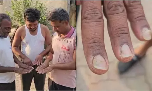 Mystery News: ఆ గ్రామంలో చేతబడులు? తలవెంట్రుకులు ఊడిపోతున్నాయ్.. గోర్లు తెగిపోతున్నాయ్..